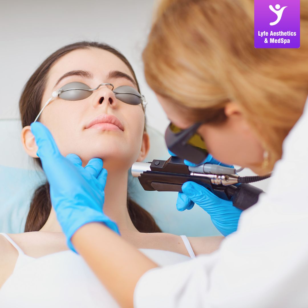 Revitalize Your Skin with LYFE Wrinkle Removal (TOX): Unveiling the Power of Botox, Xeomin, Juveau, and Dysport Wrinkle Removal