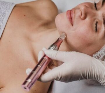 Benefits of Microneedling For Skin benefits-of-microneedling-for-skin