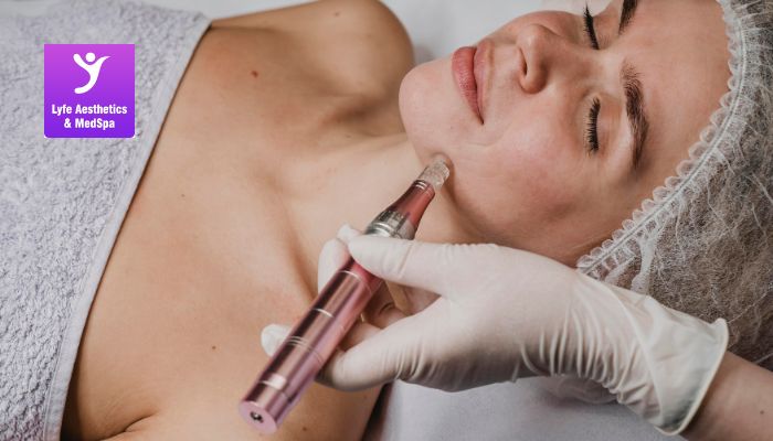 Benefits of Microneedling For Skin benefits-of-microneedling-for-skin