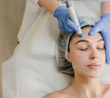 How does Microneedling Looks like? how-does-microneedling-look-like