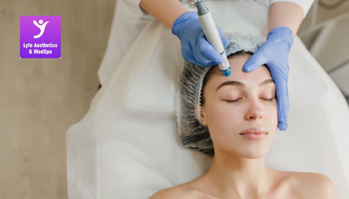 How does Microneedling Looks like? how-does-microneedling-look-like