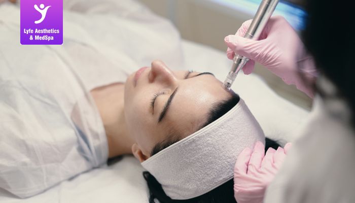 Microneedling at Home vs Professional Treatment Microneedling at Home vs Professional Treatment